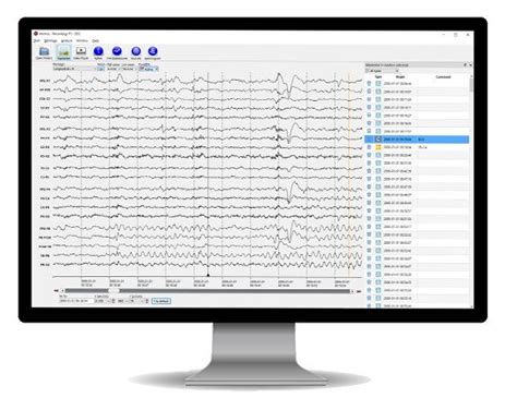 AIT Encevis 2.1.1.61769 Download